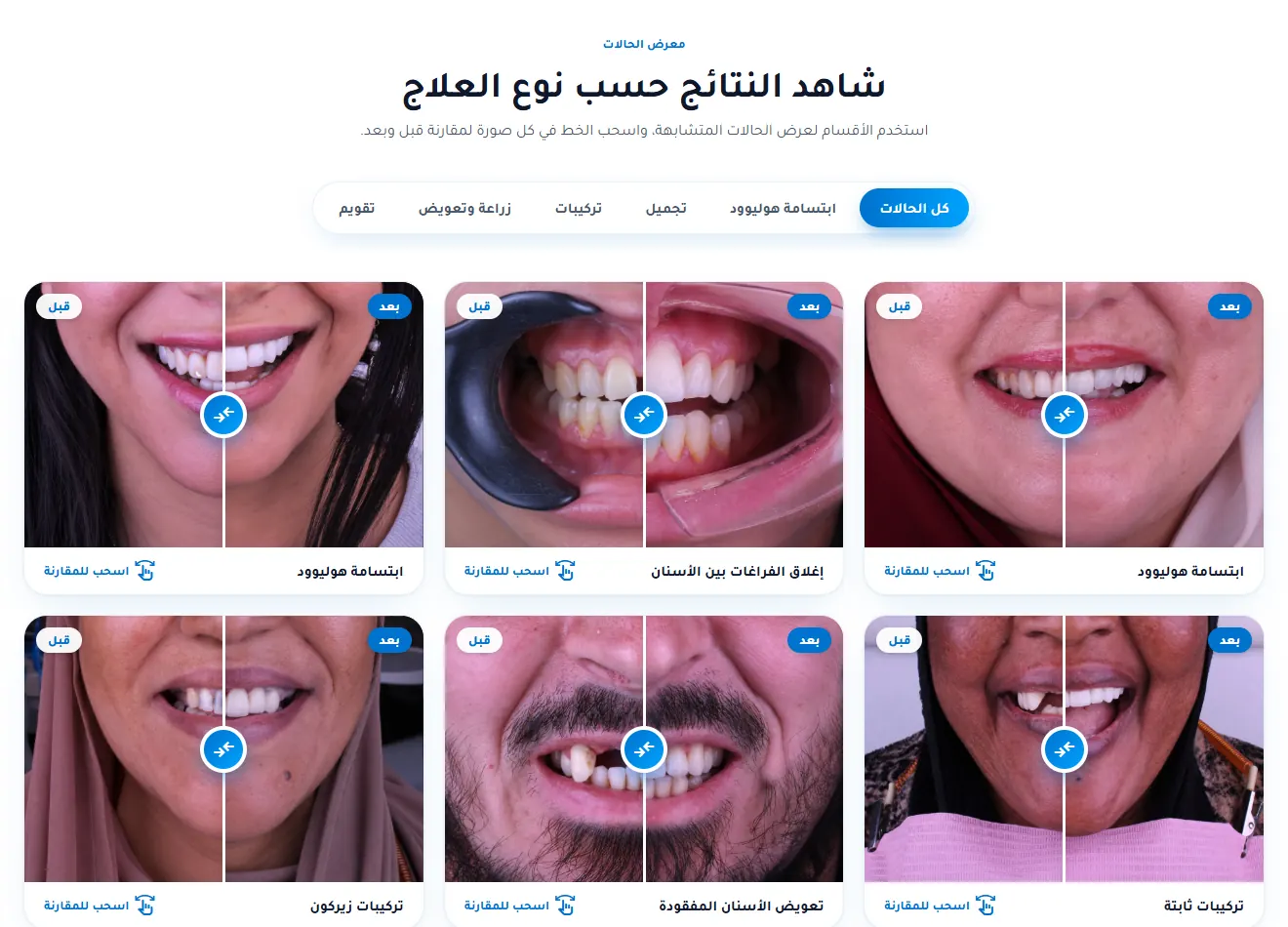 معرض حالات قبل وبعد في موقع Dental Arts