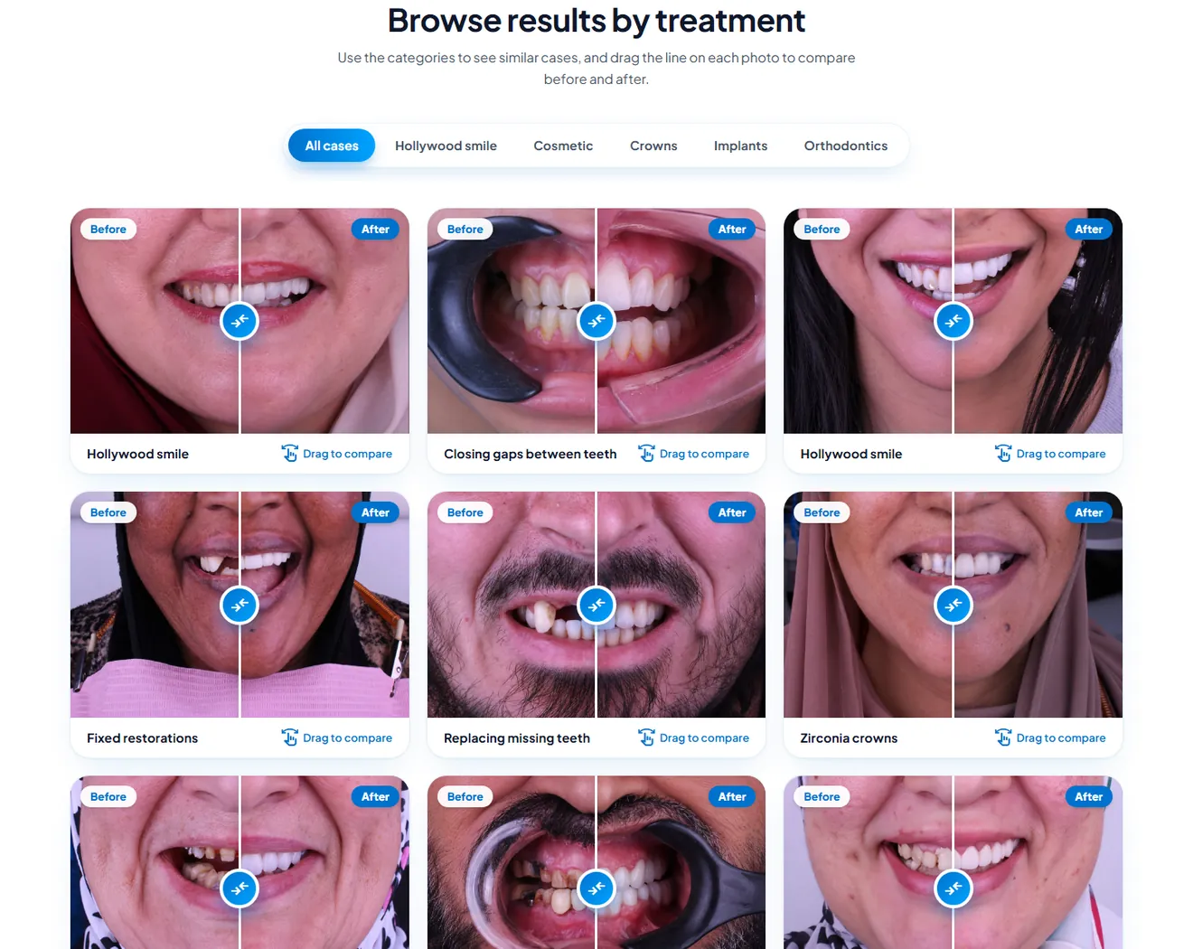 The before-and-after case gallery on the Dental Arts site