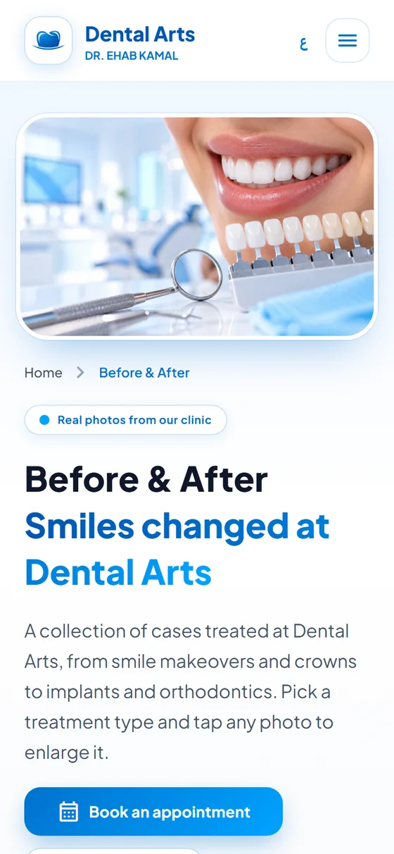 Dental Arts — Dr. Ehab Kamal Clinic — Before-and-after cases on mobile