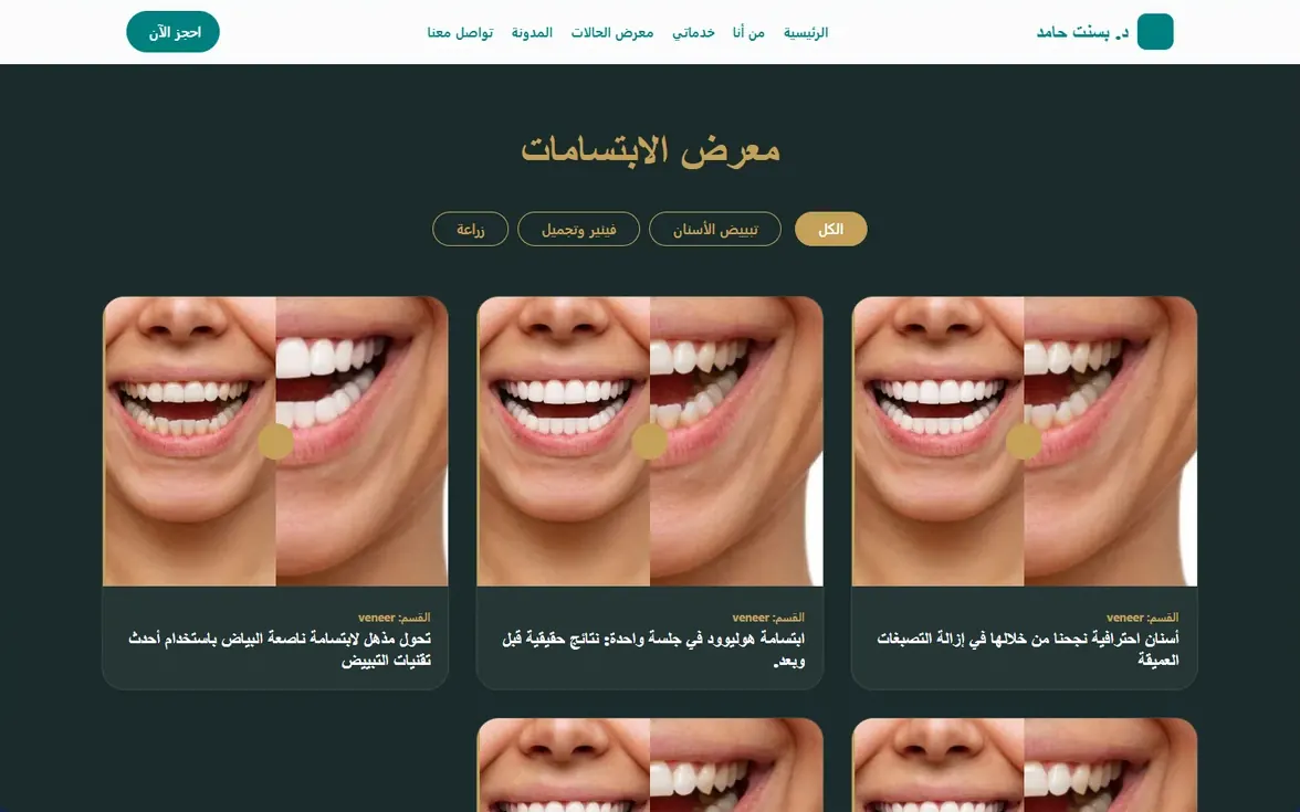 معرض الابتسامات بفلتر حسب نوع العلاج في موقع د. بسنت حامد